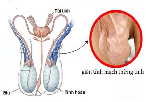 Hình ảnh tinh hoàn bình thường ở người Việt Nam