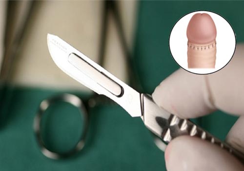 Top 5 địa chỉ khám viêm bao quy đầu ở đâu TPHCM tốt nhất