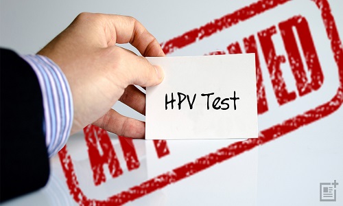 Xét nghiệm HPV mất bao lâu thì có kết quả