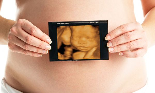 Chi phí siêu âm 3D hết bao nhiêu tiền