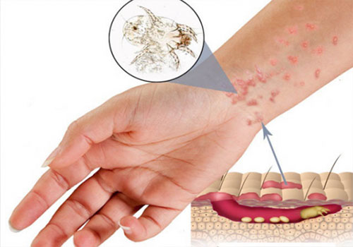 Những bệnh về da nguy hiểm cần chú ý