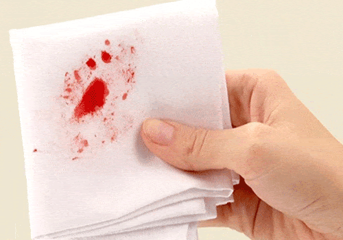 Dấu hiệu đặt vòng không hợp mà bạn cần chú ý