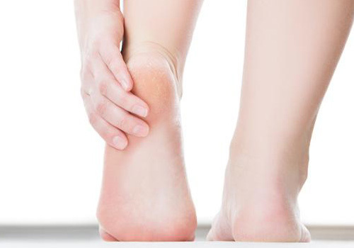 Bị nứt gót chân là thiếu chất gì