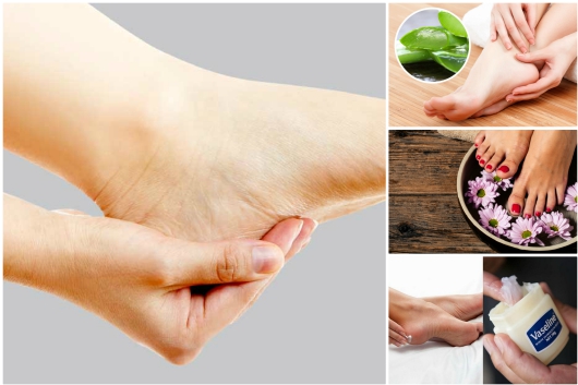 Bị nứt gót chân là thiếu chất gì