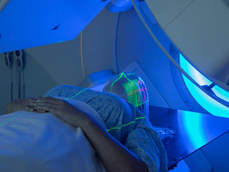 Complications of head and neck radiotherapy