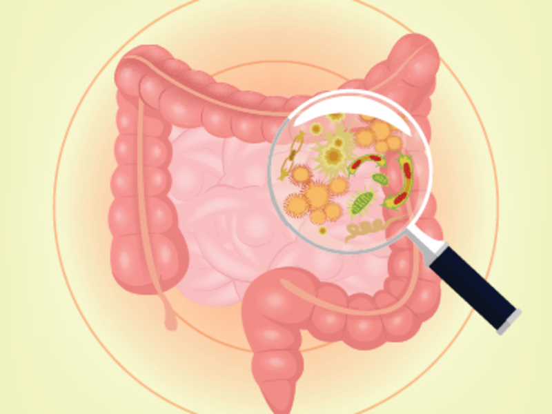 Taeniasis (tape worm) Diagnosis, treatment and prevention