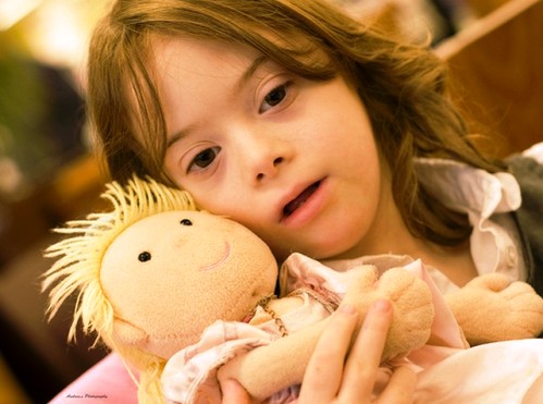 sindrome down