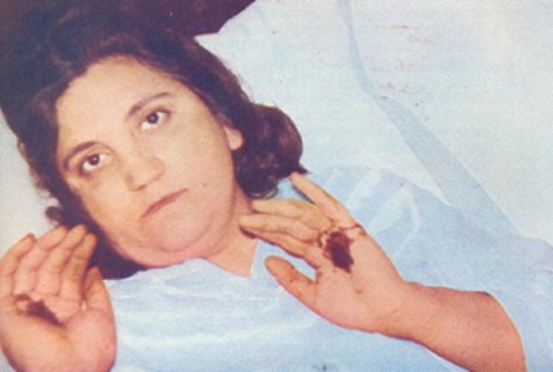 manos de teresa musco