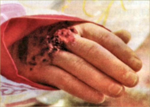 mano con estigmas padre pio