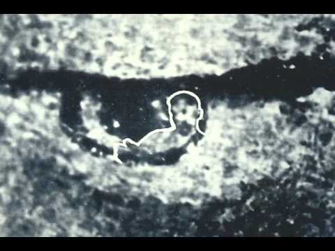 ojo-virgen-de-guadalupe