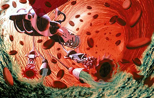 nanobots