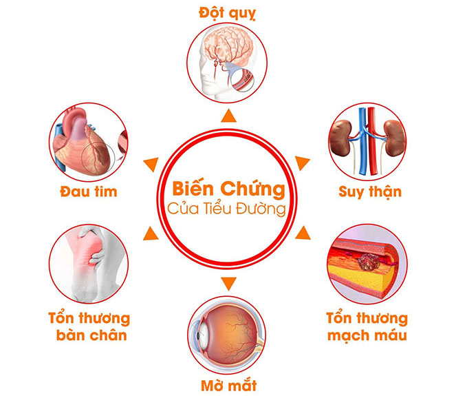 benh tieu duong