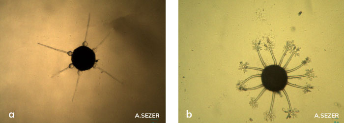 Phyllactinia guttata’nın kleistotesiyumu ve Erysiphe corylacearum’un kleistotesiyumu
