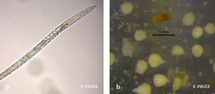 Kök-ur nematodu larvası ve dişileri