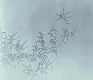 Rhodococcus bakterileri