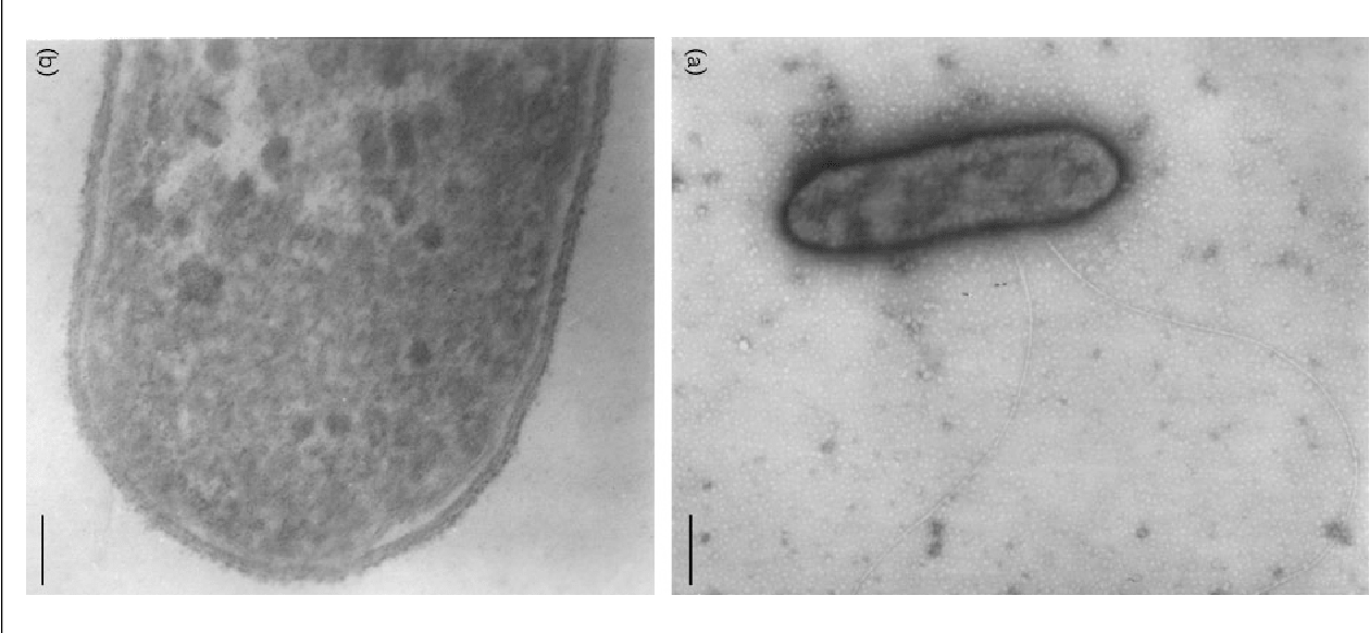 Proteiniphilum acetatigenes görünümü