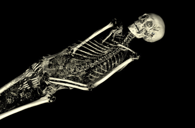 The CT scan of the mummy of an adult male (name unknown), showing his skeleton. © Trustees of the British Museum.