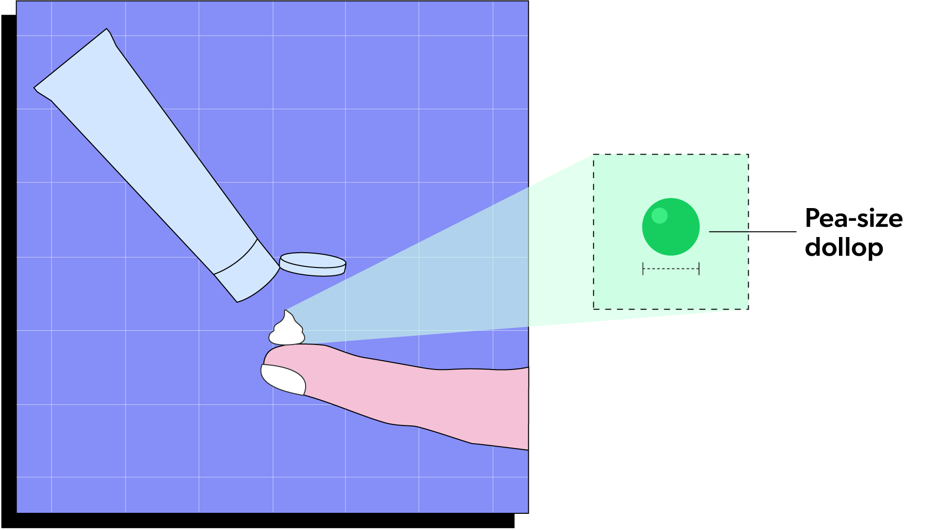 Squeeze a pea sized amount of acne cream onto your finger