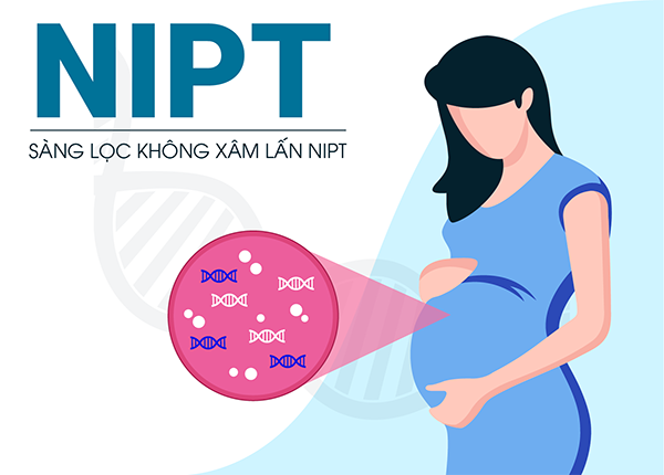 Sàng lọc trước sinh NIPT phân tích ADN tự do của thai nhi
