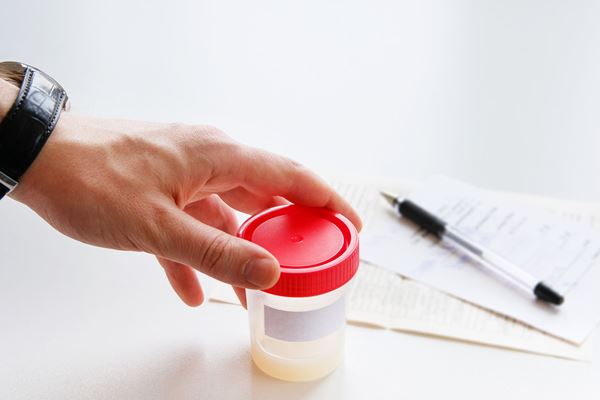 Để có kết quả xét nghiệm tinh dịch đồ chính xác nhất thì nam giới cần thực hiện cách lấy mẫu chuẩn và bảo quản đúng quy định.