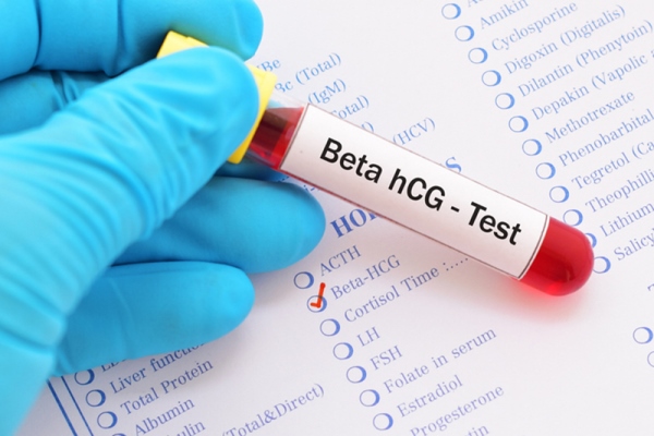 Xét nghiệm beta HCG có giá trị trong việc phát hiện thai sớm và đánh giá sự phát triển của thai.