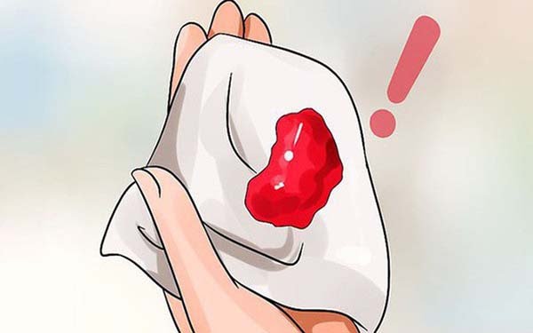 Xuất huyết âm đạo là một trong những dấu hiệu dễ nhận biết nhất
