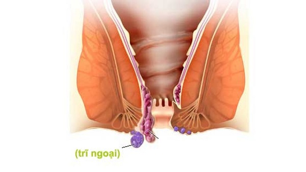 chua-tri-ngoai