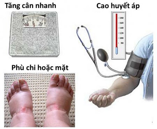 dau-hieu-nhan-biet-tien-san-giat