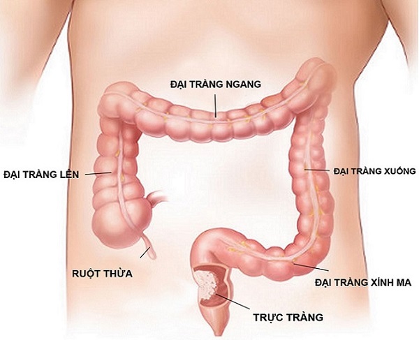 Trực tràng là cầu nối giữa đại tràng và hậu môn