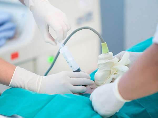 Chọc ối cho kết quả chính xác gần như tuyệt đối