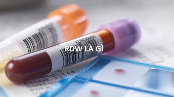 chỉ số rdw là gì?