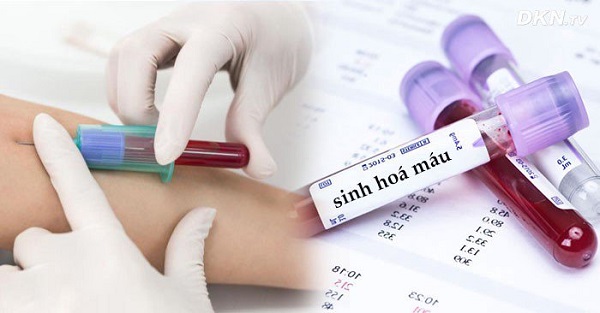 Chỉ số MCH thấp có sao không?