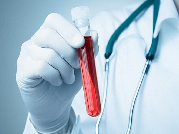 chỉ số mchc cao cần cảnh giác điều này