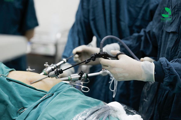 Hình ảnh các bác sĩ đang tập trung điều trị polyp túi mật