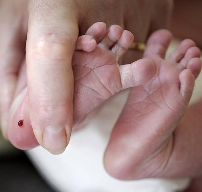 Lấy máu gót chân có vai trò vô cùng quan trọng trong việc sàng lọc sơ sinh.
