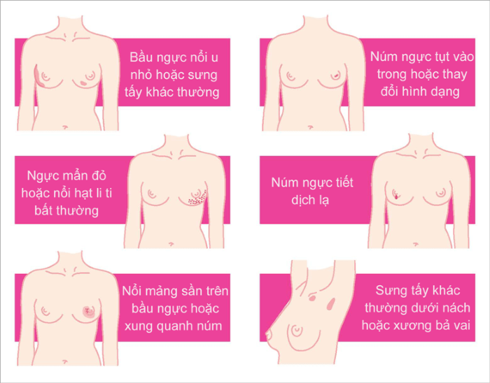 Khi vùng ngực có những thay đổi bất thường, không được chủ quan.