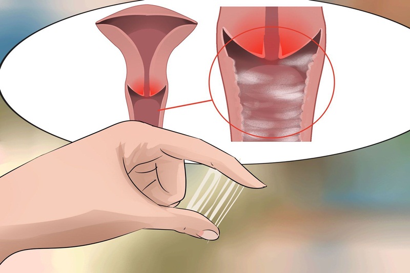 Khi bị bệnh, huyết trắng sẽ có màu sắc bất thường kèm theo mùi hôi khó chịu.