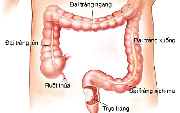 Trực tràng là gì? Trực tràng nằm ở đâu?