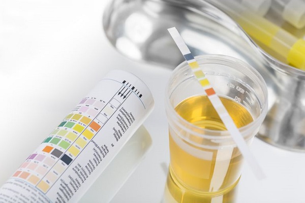 Chỉ số xét nghiệm Leukocytes (LEU) tăng cao có thể cảnh báo nhiều bệnh lý nguy hiểm