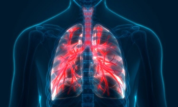 trieeujc hứng bệnh phổi tắc nghẽn mạn tính