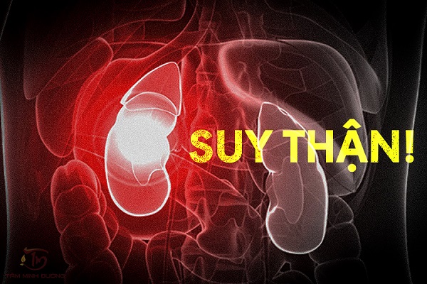 Suy thận có thể ảnh hưởng nghiêm trọng tới sức khỏe