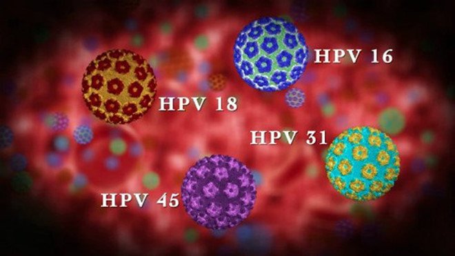 HPV type 16 và 18 chiếm 70% các ca mắc ung thư cổ tử cung.
