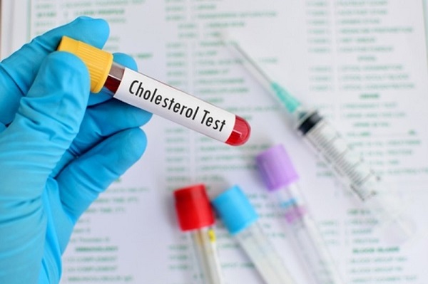 Chỉ số cholesterol cao có thể gây ra những nguy hiểm gì?