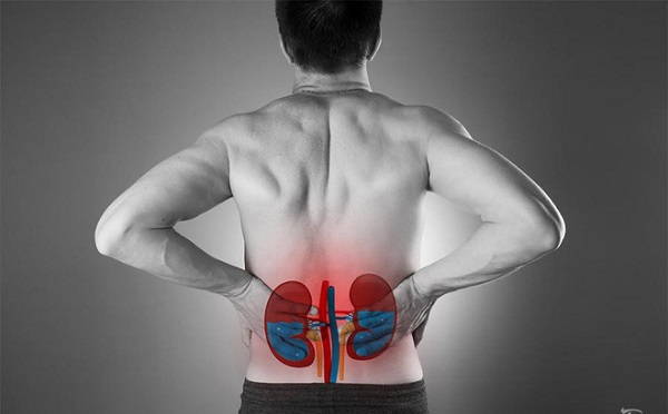 Những cơn đau lưng báo hiệu thận ứ nước