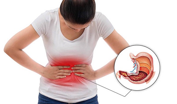 Đau thượng vị thường gây ra bởi các bệnh lý về dạ dày