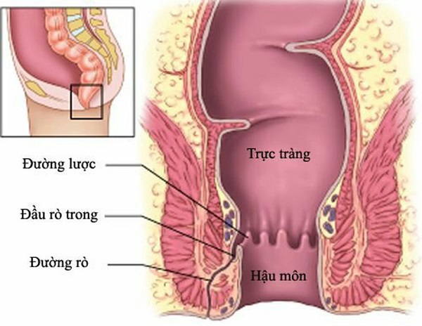 ro-hau-mon-nguyen-nhan-dau-hieu-va-phuong-phap-dieu-tri