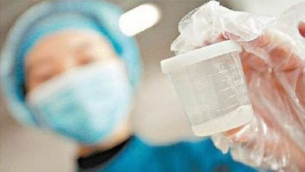 Tinh trùng loãng có những đắc điểm gì?