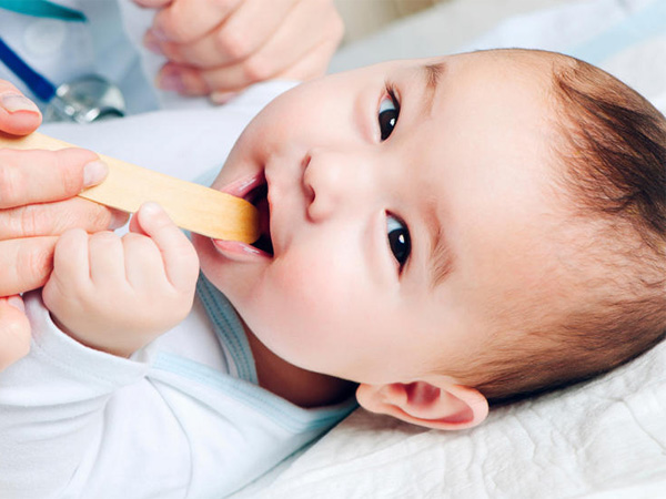 Khi nào cần phẫu thuật cắt dính thắng lưỡi