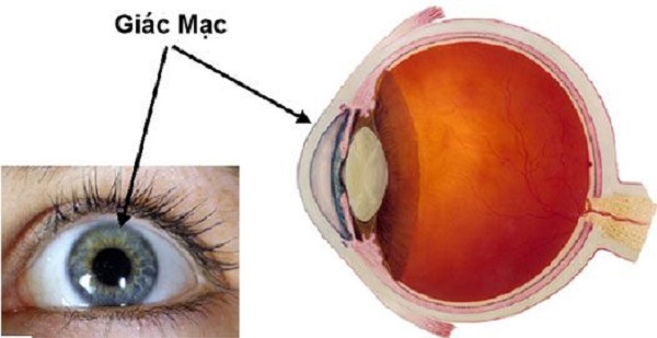 Giác mạc mắt là gì