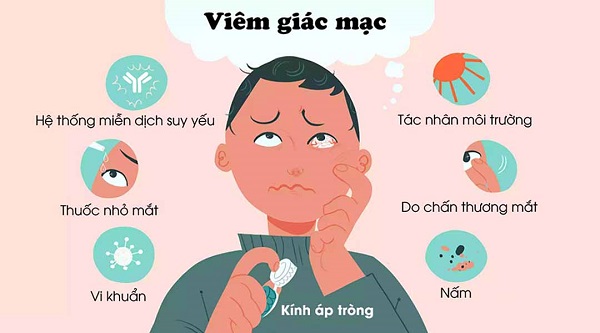 nguyên nhân gây viêm giác mạc mắt